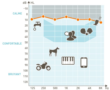 L'audiogramme tonal