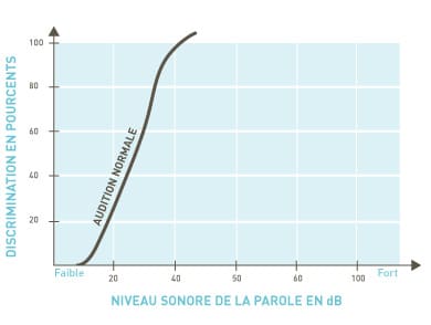 L'audiogramme vocal